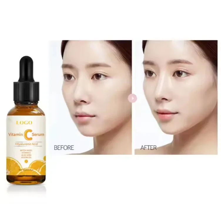 30ml French Golden Vitamin-C Serum
