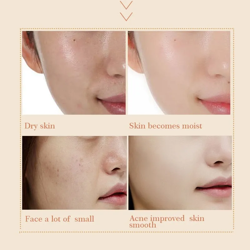 Anti Aging Snail Essence Face Cream Whitening