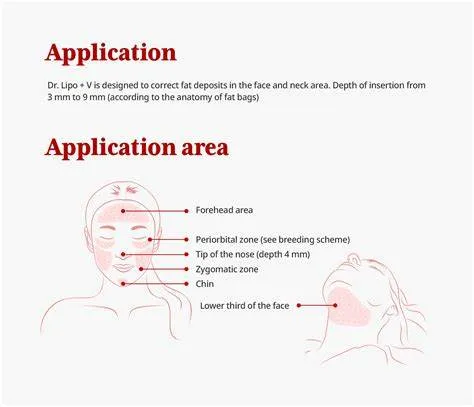Dr. Lipo   V