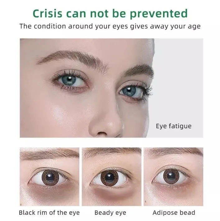 Dr Rashel Green Tea Revitalizing Eye Cream Dilute Dark Circles Eye Bags And Puffiness DRL- 1643