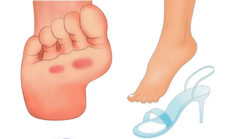 DR.KONG BIO-GEL FOREFOOT CUSHION ACCESSORIES DK-DKA26-F