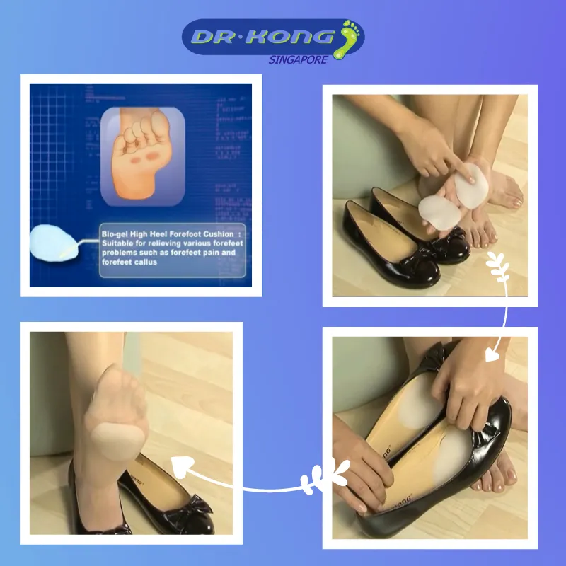 DR.KONG BIO-GEL FOREFOOT CUSHION ACCESSORIES DK-DKA26-F