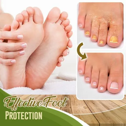 FUNGALCOMBAT FEET SPRAY