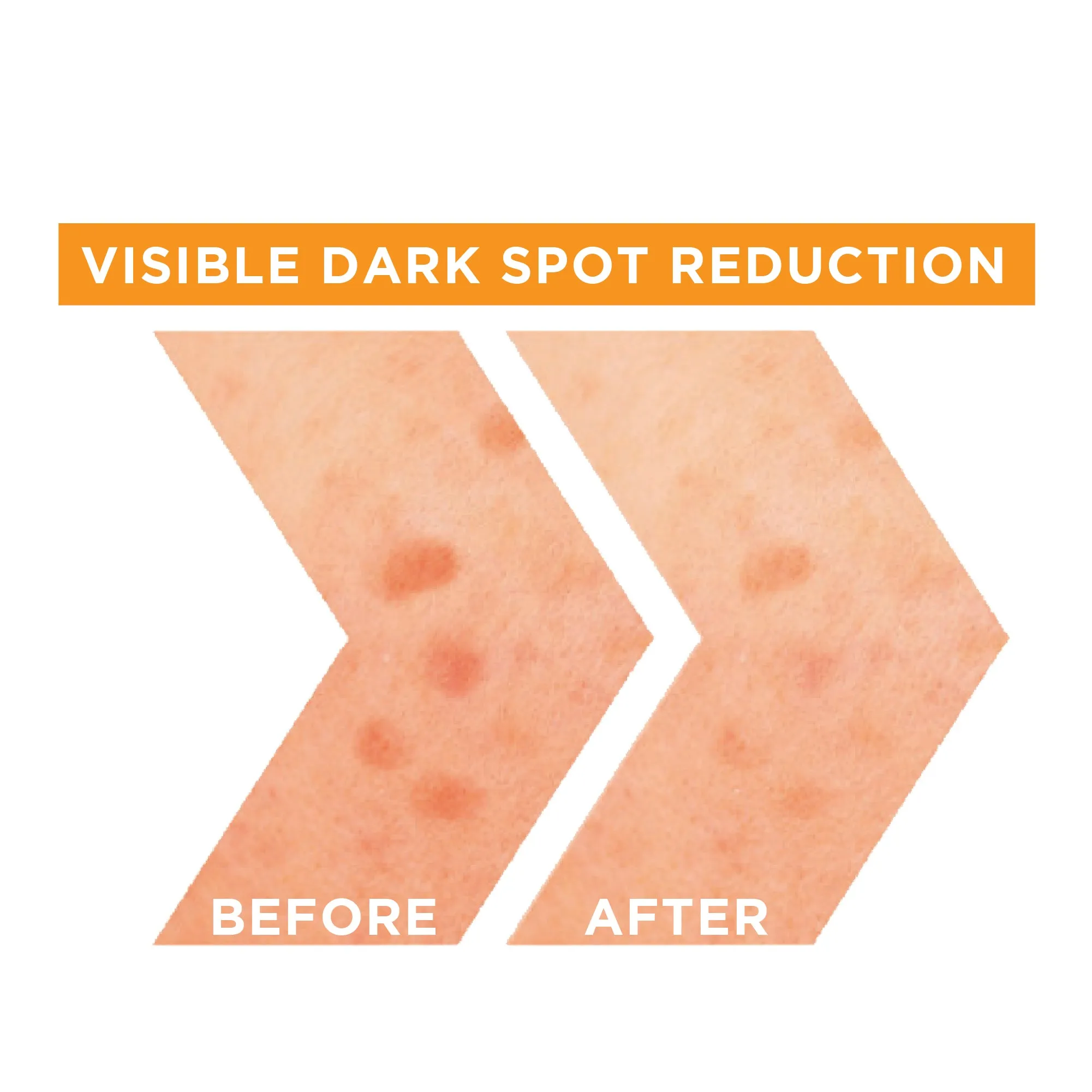 Garnier Fast Bright Vitamin C   Niacinamide 30x Brightening Booster Serum