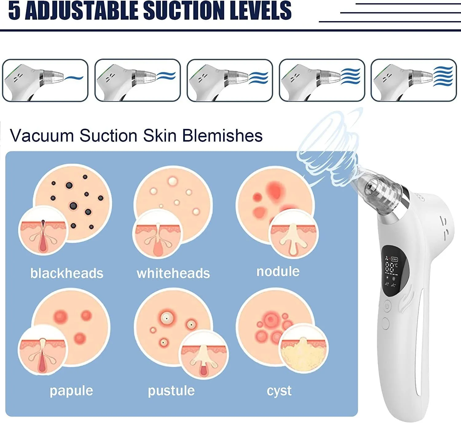 ION Skin Cleaning Beauty Instrument 5-Level Suction, USB Rechargeable, Deep Cleansing Tool, lioness-love