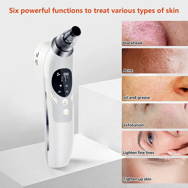 ION Skin Cleaning Beauty Instrument 5-Level Suction, USB Rechargeable, Deep Cleansing Tool, lioness-love