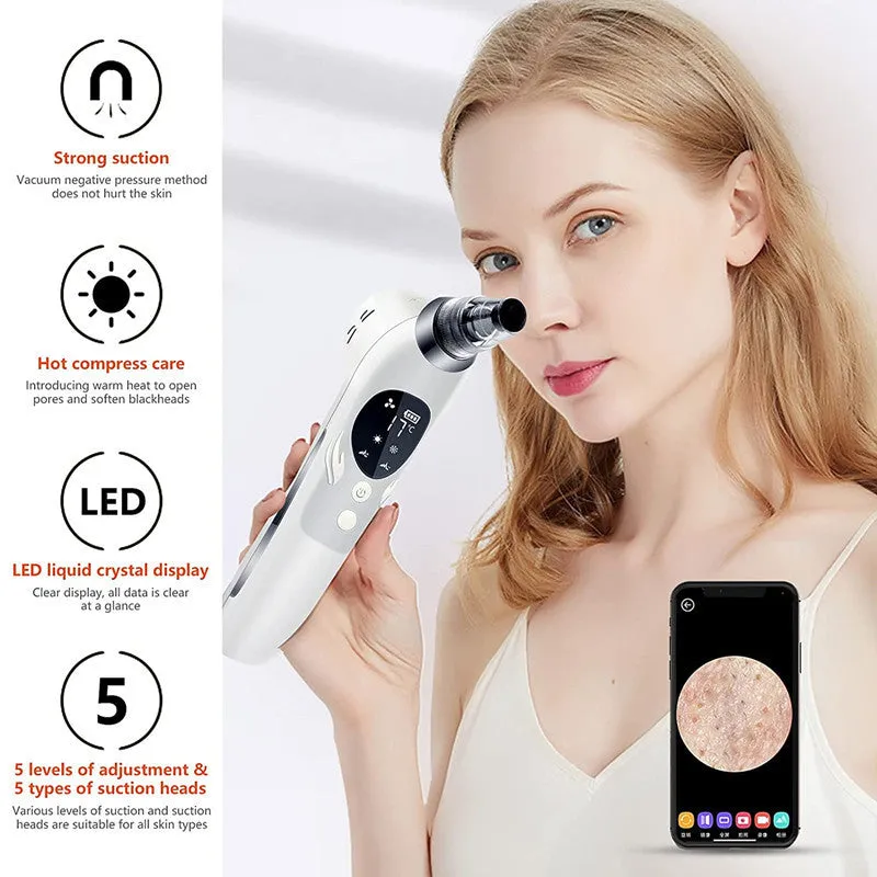ION Skin Cleaning Beauty Instrument 5-Level Suction, USB Rechargeable, Deep Cleansing Tool, lioness-love