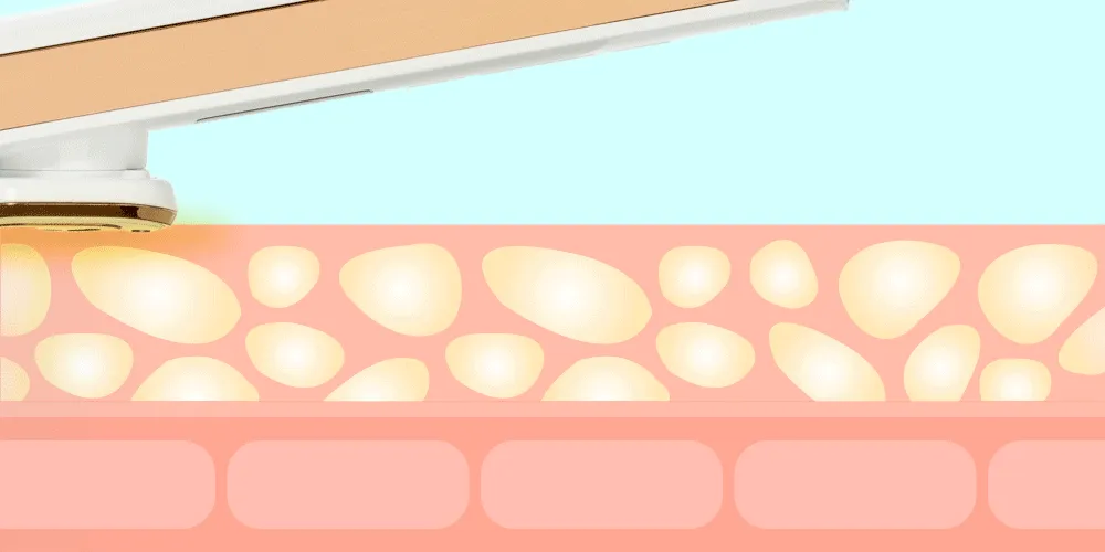 LED Light Care Wand