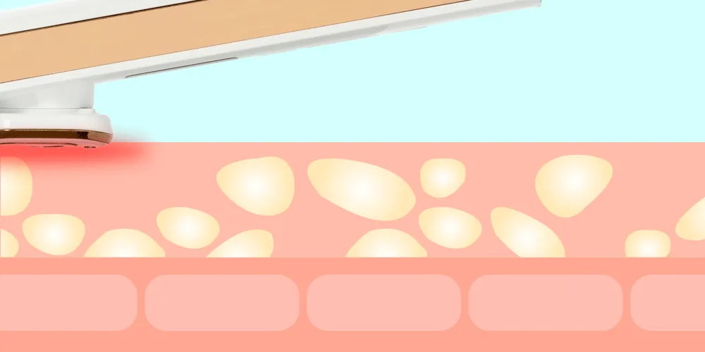 LED Light Care Wand