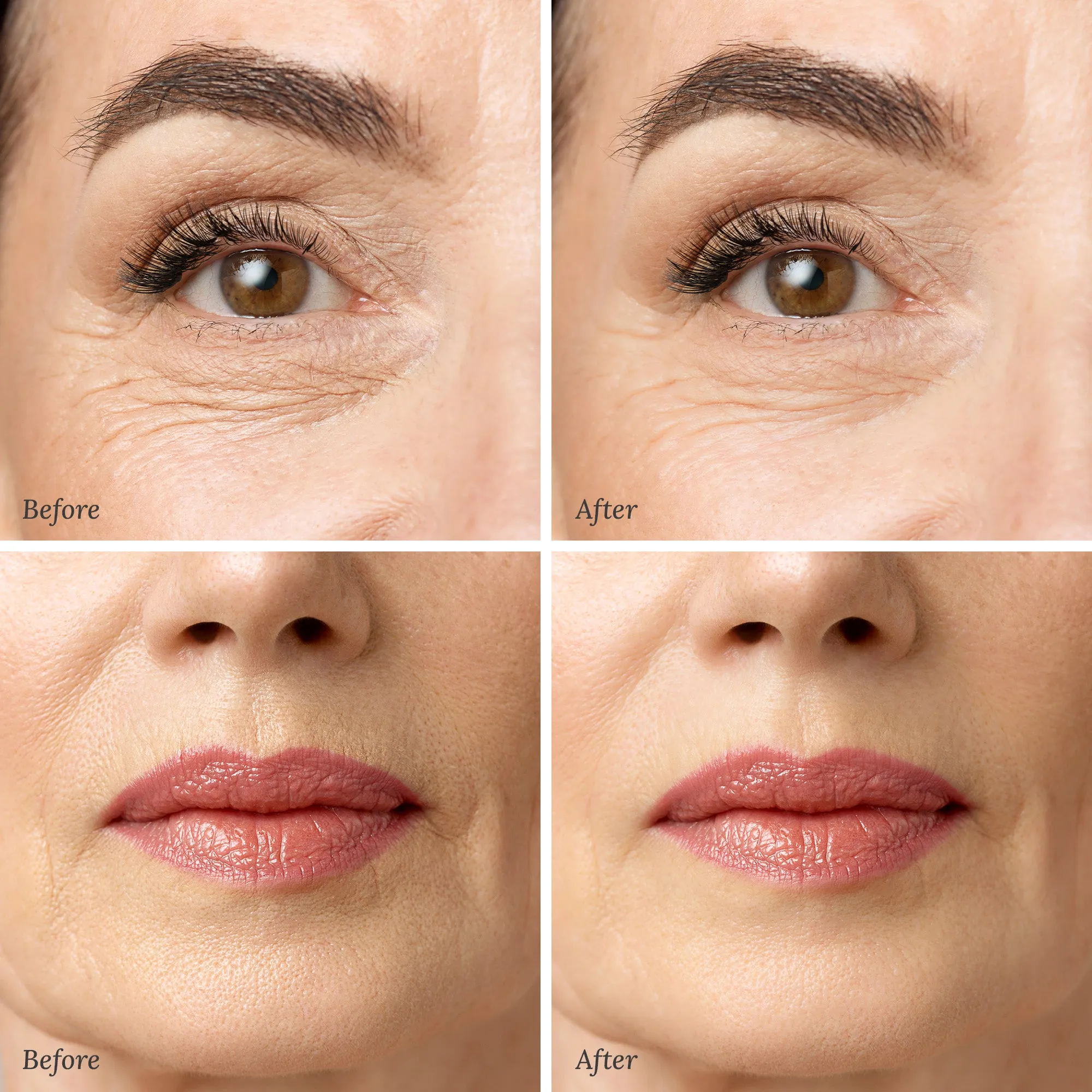 Line Smoother   Primer with Neodermyl®