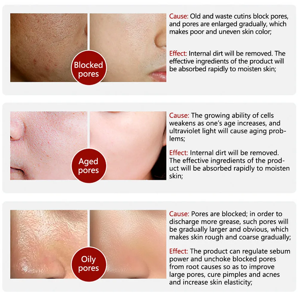 Pore Solution Serum